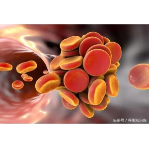 提醒：出现四个信号，说明血粘稠了，需警惕血栓，五种食物要少吃