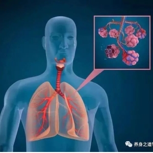 长期抽烟者，身上若出现“3粗、2痛”，警惕肺癌，再有瘾也别碰了